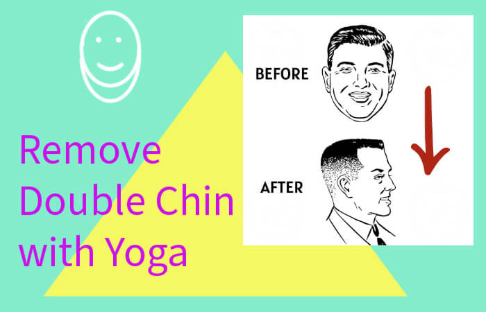 Double chin removal