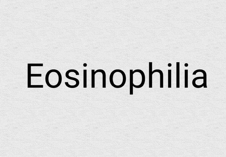Yoga cure for Eosinophilia