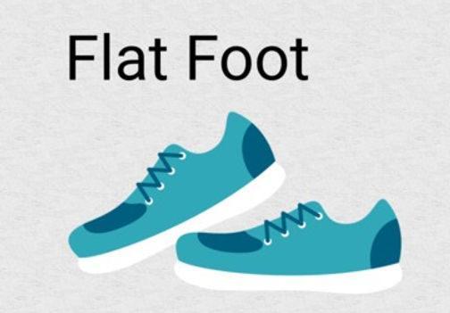 Yoga for flat foot