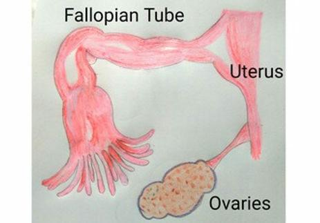 Ayurvedic Herbal Treatment of PCOS Polycystic Ovarian Syndrome in Adelaide